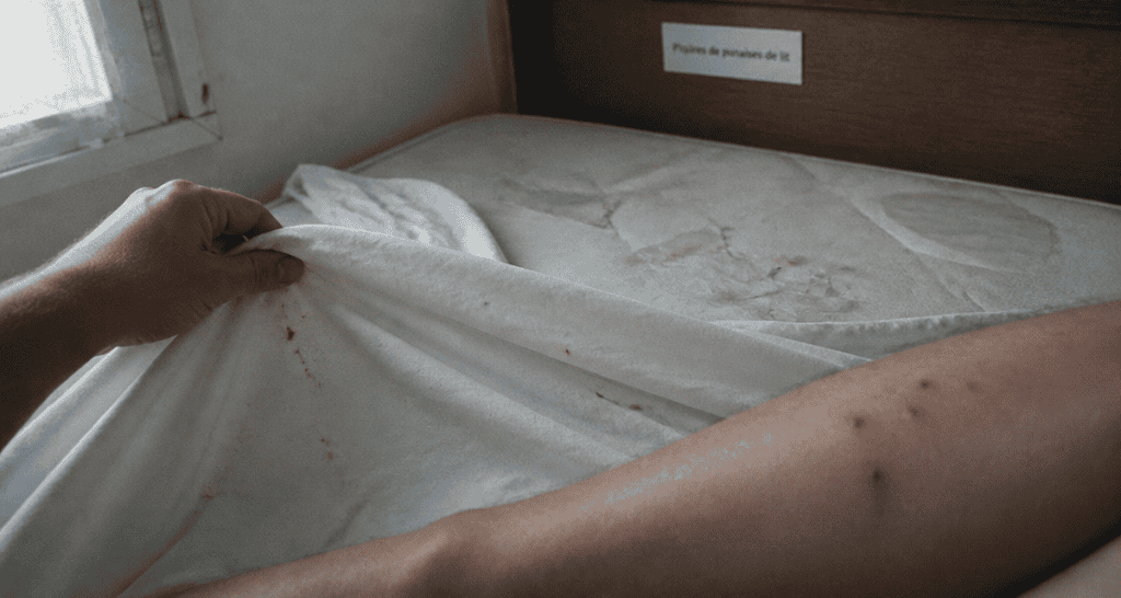 piqures punaises de lit symptomes sur drap et bras